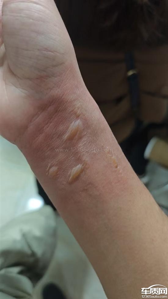 长安福特蒙迪欧电子扇故障 发动机高温<em>开锅</em>